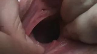 मैले त्यो कुरा बुझिनँ।